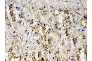 Alpha Internexin was detected in paraffin-embedded sections of rat brain tissues using rabbit anti- Alpha Internexin Antigen Affinity purified polyclonal antibody (Catalog # ) at 1 µg/mL. (INA antibody  (AA 71-161))