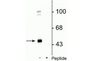Western blot of rat cortical lysate showing specific immunolabeling of the ~45 kDa GABAA γ2 protein phosphorylated at Ser327 in the first lane (-).