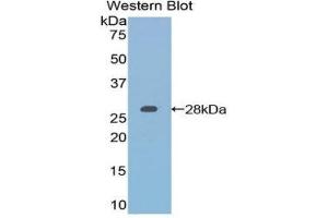 Western Blotting (WB) image for anti-Retinoic Acid Receptor, alpha (RARA) (AA 237-459) antibody (ABIN1860408) (Retinoic Acid Receptor alpha antibody  (AA 237-459))