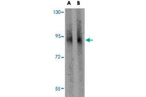 Western blot analysis of GLE1 in mouse brain tissue lysate with GLE1 polyclonal antibody  at (A) 1 and (B) 2 ug/mL . (GLE1 antibody  (C-Term))