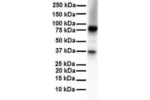 WB Suggested Anti-CPEB4 antibody Titration: 1 ug/mL Sample Type: Human Daudi (CPEB4 antibody  (N-Term))