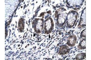 Image no. 1 for anti-Hematopoietic Cell-Specific Lyn Substrate 1 (HCLS1) (AA 28-77) antibody (ABIN6735791) (HCLS1 antibody  (AA 28-77))