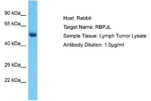 Host: Rabbit Target Name: RBPJL Sample Type: Lymph Tumor lysates Antibody Dilution: 1. (RBPJL antibody  (N-Term))