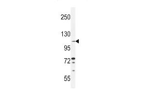 TLL2 Antibody (Center) (ABIN655266 and ABIN2844859) western blot analysis in ZR-75-1 cell line lysates (35 μg/lane). (Tolloid-Like 2 antibody  (AA 298-328))