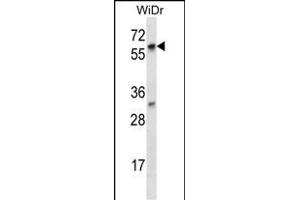 LARP7 Antibody (C-term) (ABIN656914 and ABIN2846110) western blot analysis in WiDr cell line lysates (35 μg/lane). (LARP7 antibody  (C-Term))