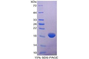 SDS-PAGE (SDS) image for Collagen, Type VIII, alpha 2 (COL8A2) (AA 537-703) protein (His tag) (ABIN1098983)