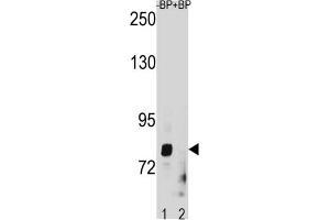 Western Blotting (WB) image for anti-Zinc Finger, Matrin-Type 1 (ZMAT1) antibody (ABIN3004468) (ZMAT1 antibody)