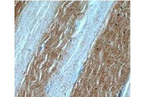 Immunohistochemical of paraffin-embedded human skeletal muscle using (LDHA antibody) at dilution of 1:50.