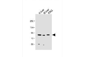 All lanes : Anti-MUT Antibody (Center) at 1:2000 dilution Lane 1: Human liver lysate Lane 2: Mouse liver lysate Lane 3: K562 whole cell lysate Lysates/proteins at 20 μg per lane. (MUT antibody  (AA 492-526))