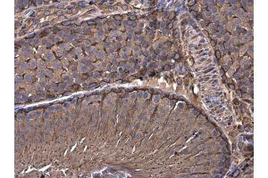 Immunohistochemistry (IHC) image for anti-Vimentin (VIM) antibody (ABIN2854814)