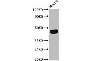 Western Blot Positive WB detected in: Rat heart tissue All lanes: TRDMT1 antibody at 4 μg/mL Secondary Goat polyclonal to rabbit IgG at 1/50000 dilution Predicted band size: 45, 42, 40, 7, 8, 13 kDa Observed band size: 45 kDa (Dnmt2 antibody  (AA 170-269))