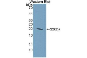 Western Blotting (WB) image for anti-Glucokinase (Hexokinase 4) Regulator (GCKR) (AA 320-499) antibody (ABIN1859015) (GCKR antibody  (AA 320-499))