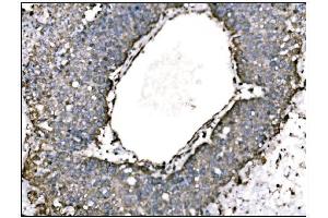 IHC analysis of TRAP Alpha/TRAPA/SSR1 using anti-TRAP Alpha/TRAPA/SSR1 antibody (ABIN7601975).