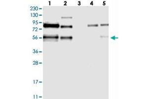 Western blot analysis of Lane 1: RT-4, Lane 2: U-251 MG, Lane 3: Human Plasma, Lane 4: Liver, Lane 5: Tonsil with TJAP1 polyclonal antibody . (TJAP1 antibody)