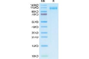 SARS-CoV-2 Spike S1 (Omicron BA. (SARS-CoV-2 Spike S1 Protein (BA.2.12.1 - Omicron) (His tag))