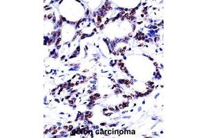 Immunohistochemistry (IHC) image for anti-Heterogeneous Nuclear Ribonucleoprotein M (HNRNPM) antibody (ABIN2997669)