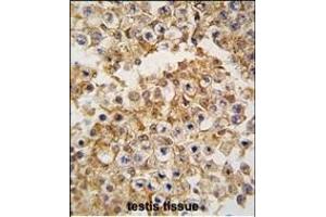 Formalin-fixed and paraffin-embedded human testis tissue reacted with FARSB antibody (N-term) (ABIN6243562 and ABIN6579027) , which was peroxidase-conjugated to the secondary antibody, followed by DAB staining. (FARSB antibody  (N-Term))