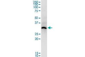 ASB5 monoclonal antibody (M03), clone 6B10. (ASB5 antibody  (AA 220-328))