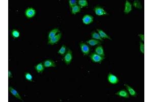 Immunofluorescent analysis of PC-3 cells using ABIN7154380 at dilution of 1:100 and Alexa Fluor 488-congugated AffiniPure Goat Anti-Rabbit IgG(H+L) (GRHL3 antibody  (AA 31-182))