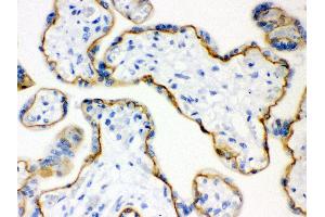 Immunohistochemistry (Paraffin-embedded Sections) (IHC (p)) image for anti-Cadherin 1, Type 1, E-Cadherin (Epithelial) (CDH1) (AA 286-703) antibody (ABIN3043808) (E-cadherin antibody  (AA 286-703))