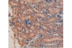 IHC-P analysis of Mouse Kidney Tissue, with DAB staining. (PD-L1 antibody  (AA 34-241))