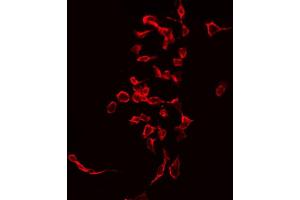ABIN6268951 staining Hela by IF/ICC. (CD247 antibody  (C-Term))