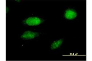 Image no. 2 for anti-Forkhead Box C2 (MFH-1, Mesenchyme Forkhead 1) (FOXC2) (AA 421-502) antibody (ABIN466014) (FOXC2 antibody  (AA 421-502))