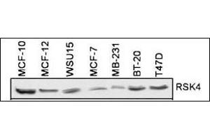 RSK4 Antibody (N-term) (ABIN1882127 and ABIN2842047) is used to detect RSK4 in 7 different cell lines. (RPS6KA6 antibody  (N-Term))