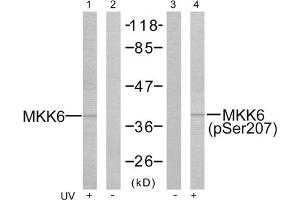 Western blot analysis of the extracts from MDA-MB- 435 cells treated or untreated with UV using MKK3 (epitope around residue 207) Antibody (ABIN5976000) and MKK6 (Phospho-Ser207) Antibody (ABIN59760003).