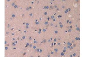 DAB staining on IHC-P; Samples: Mouse Cerebrum Tissue (LAMB2 antibody  (AA 1498-1716))