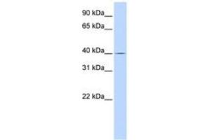 Image no. 1 for anti-Solute Carrier Family 22 Member 18 (SLC22A18) (AA 180-229) antibody (ABIN6743206) (ORCTL-2/SLC22A18 antibody  (AA 180-229))