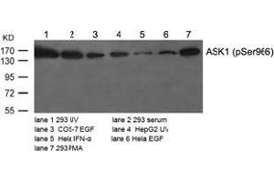 Image no. 2 for anti-Mitogen-Activated Protein Kinase Kinase Kinase 5 (MAP3K5) (pSer966) antibody (ABIN196915) (ASK1 antibody  (pSer966))
