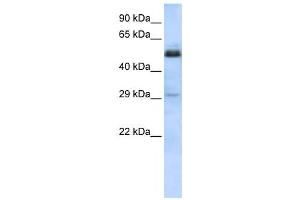 Western Blotting (WB) image for anti-Sex Comb On Midleg-Like 1 (SCML1) antibody (ABIN2458173) (SCML1 antibody)