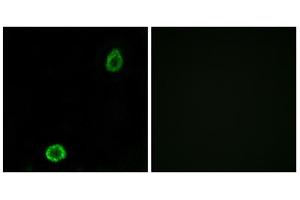 Immunofluorescence analysis of A549 cells, using ABCA13 antibody. (ABCA13 antibody  (Internal Region))