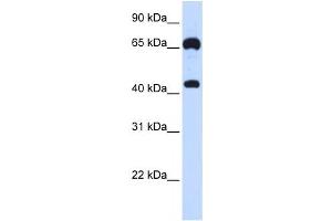 Western Blotting (WB) image for anti-Guanylate Cyclase 1, Soluble, beta 3 (GUCY1B3) antibody (ABIN2458977) (GUCY1B3 antibody)