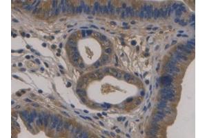 DAB staining on IHC-P; Samples: Mouse Uterus Tissue) (Fibulin 1 antibody  (AA 399-578))