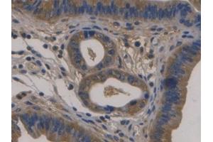 DAB staining on IHC-P; Samples: Mouse Uterus Tissue)