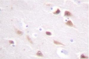 Image no. 2 for anti-Casein Kinase 2, beta (CSNK2B) antibody (ABIN272014) (CSNK2B antibody)