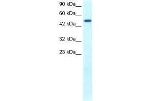 WB Suggested Anti-FLJ14768 Antibody Titration: 1. (FIZ1 antibody  (C-Term))