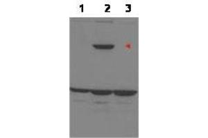 Image no. 1 for anti-Protein Phosphatase 1, Regulatory Subunit 13B (PPP1R13B) (Internal Region) antibody (ABIN291763) (PPP1R13B antibody  (Internal Region))