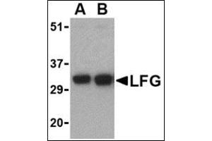 Western blot analysis of LFG in EL4 cell lysate with this product at (A) 0. (FAIM2 antibody  (N-Term))