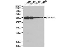 Western blot analysis of HeLa cell using β-tubulin antibody at different dilution.