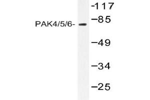 Image no. 1 for anti-P21-Activated Kinase 4 (PAK4) antibody (ABIN317882) (PAK4 antibody)