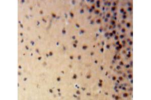 Used in DAB staining on fromalin fixed paraffin-embedded Brain tissue (LIG1 antibody  (AA 568-875))