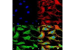 Immunocytochemistry/Immunofluorescence analysis using Mouse Anti-Copper Transporting ATPase 2 Monoclonal Antibody, Clone S62-29 . (ATP7B antibody  (AA 3-21))