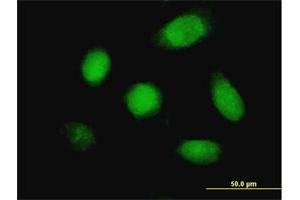 Immunofluorescence of monoclonal antibody to DUSP5 on HeLa cell. (DUSP5 antibody  (AA 286-384))