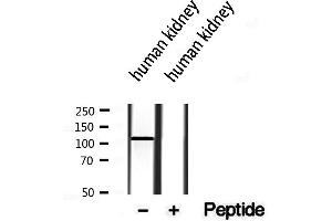 Western blot analysis of extracts from human kidney, using MKS3 antibody. (TMEM67 antibody  (Internal Region))