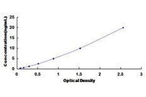 ELISA image for Histone Deacetylase 5 (HDAC5) ELISA Kit (ABIN420524) (HDAC5 ELISA Kit)