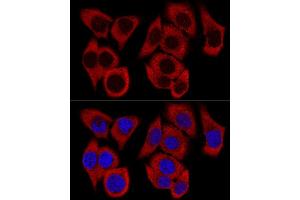 Confocal immunofluorescence analysis of HeLa cells using RPL36 Polyclonal Antibody (ABIN6129105, ABIN6147141, ABIN6147142 and ABIN6223749) at dilution of 1:200. (RPL36 antibody  (AA 1-105))