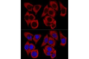 Confocal immunofluorescence analysis of HeLa cells using RPL36 Polyclonal Antibody (ABIN6129105, ABIN6147141, ABIN6147142 and ABIN6223749) at dilution of 1:200. (RPL36 antibody  (AA 1-105))